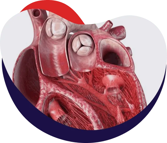 Structural Heart Procedures: Left Atrial Appendage Closure